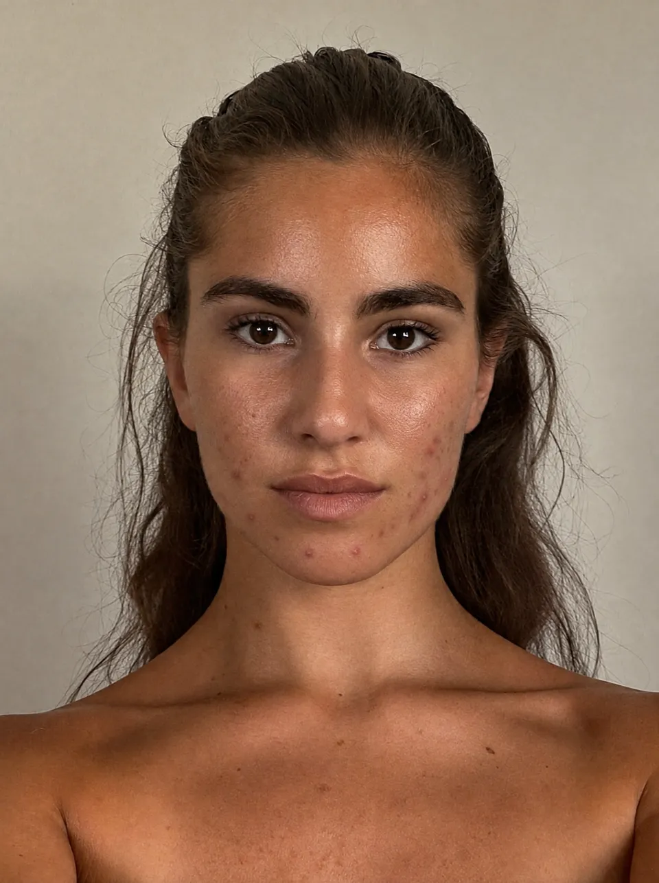 Day 1 portrait with eight blemishes circled