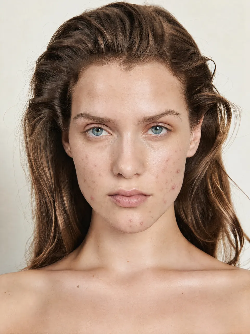 Woman with active breakouts, day 1 of tracking